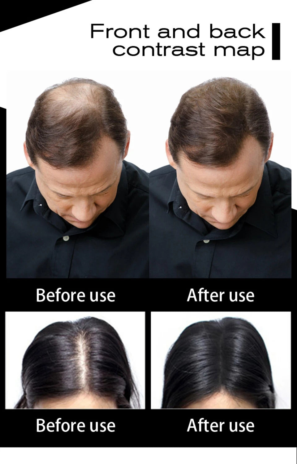 SEVICH Hair Fiber 100g Keratin Hair Fiber Thickening powder Hair Building Fiber Spray Instant Regrowth Powder Hair Loss Conceale